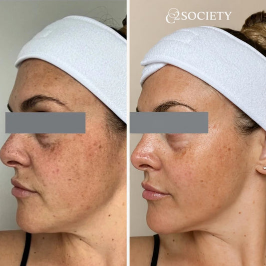 The Glow Duo - CO2 Society